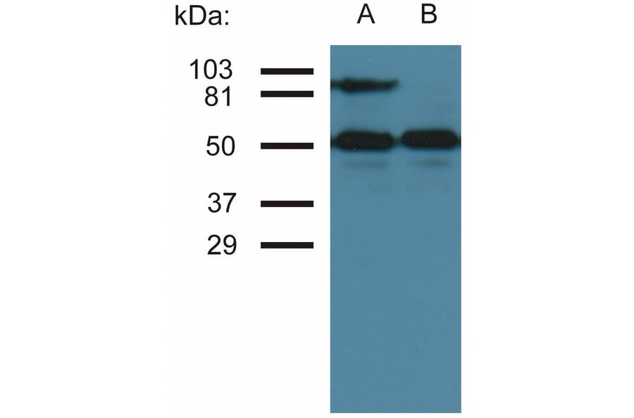 WB - Anti-ICAM1 Antibody [MEM-111] (A85684)