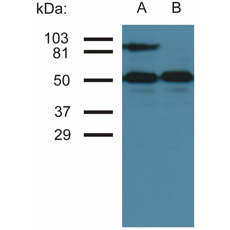 WB - Anti-ICAM1 Antibody [MEM-111] (A85684)