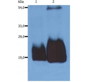 WB - Anti-CD59 Antibody [MEM-43/5] (A85695)