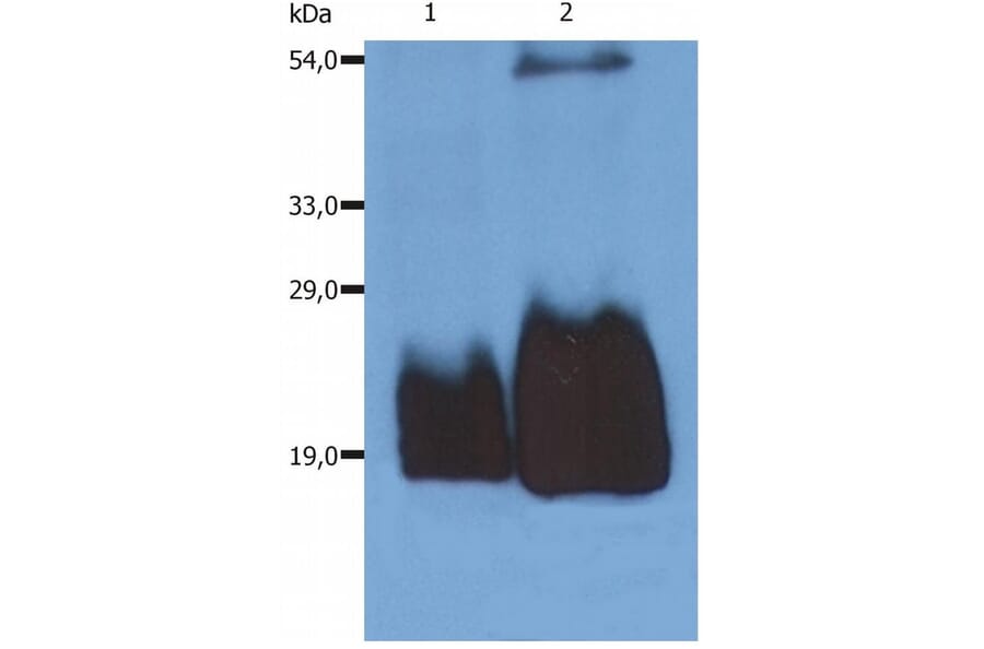 WB - Anti-CD59 Antibody [MEM-43/5] (A85695)