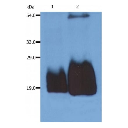 WB - Anti-CD59 Antibody [MEM-43/5] (A85695)