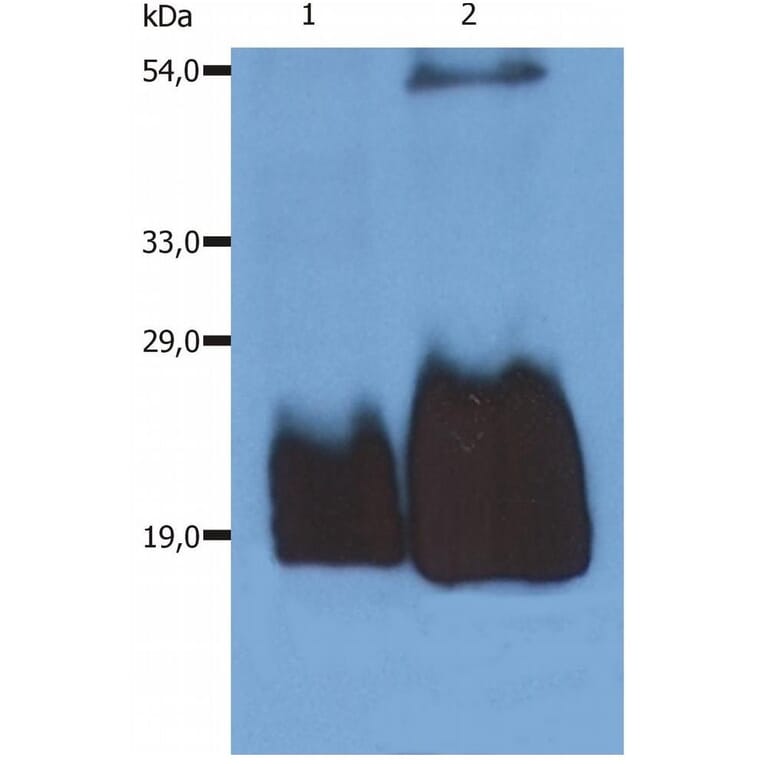 WB - Anti-CD59 Antibody [MEM-43/5] (A85695)