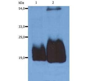 Western Blot - Anti-CD59 Antibody [MEM-43/5] (A85694) - Antibodies.com