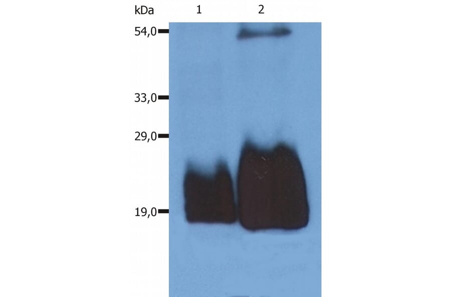 Western Blot - Anti-CD59 Antibody [MEM-43/5] (A85694) - Antibodies.com