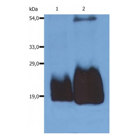 Western Blot - Anti-CD59 Antibody [MEM-43/5] (A85694) - Antibodies.com