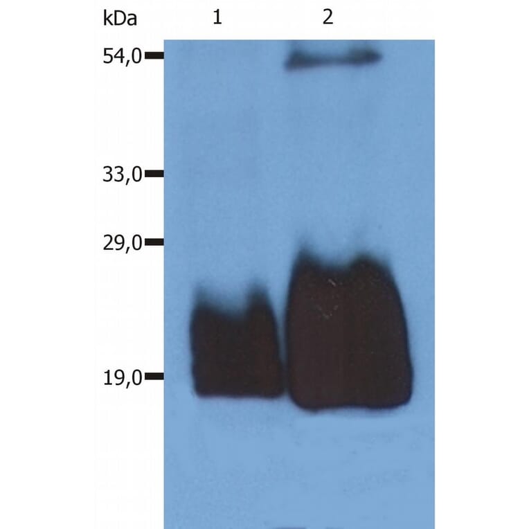 Western Blot - Anti-CD59 Antibody [MEM-43/5] (A85694) - Antibodies.com