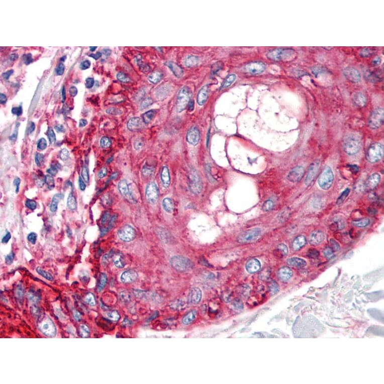 IHC - Anti-CD59 Antibody [MEM-43/5] (A85695)