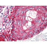 IHC - Anti-CD59 Antibody [MEM-43/5] (A85695)