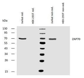 WB - Anti-ZAP70 Antibody [ZAP-03] (A85696)
