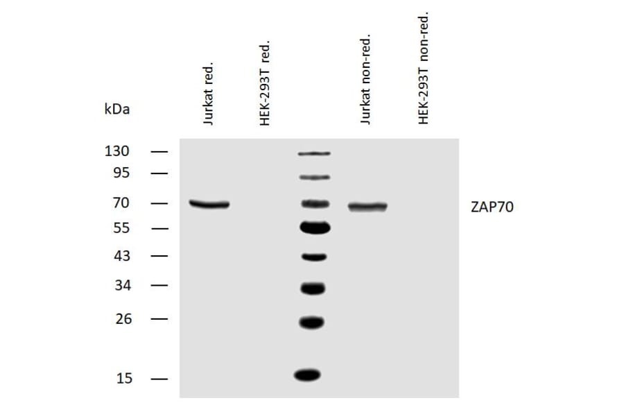 WB - Anti-ZAP70 Antibody [ZAP-03] (A85696)
