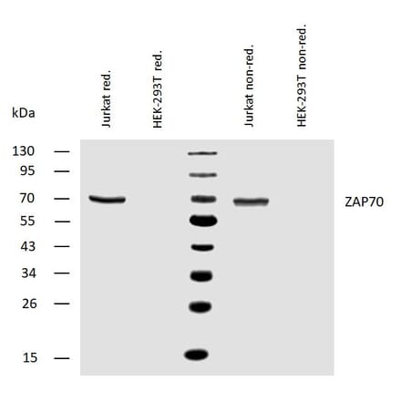 WB - Anti-ZAP70 Antibody [ZAP-03] (A85696)