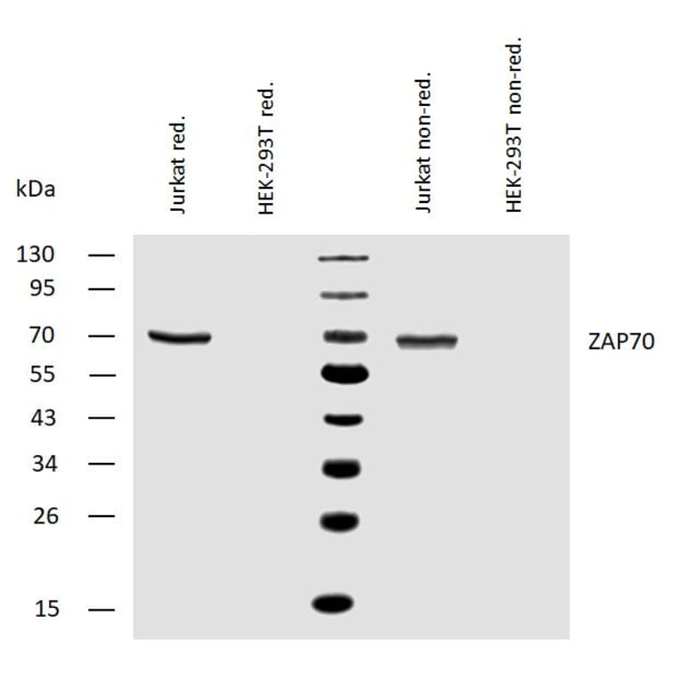 WB - Anti-ZAP70 Antibody [ZAP-03] (A85696)
