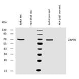 WB - Anti-ZAP70 Antibody [ZAP-03] (A85696)