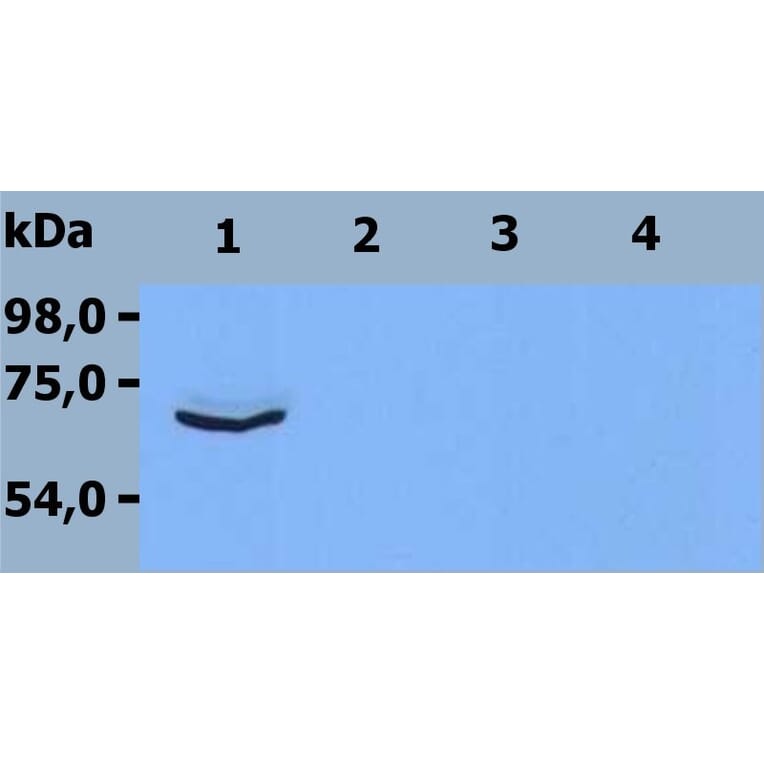 Western Blot - Anti-ZAP70 Antibody [ZAP-03] (A85695) - Antibodies.com