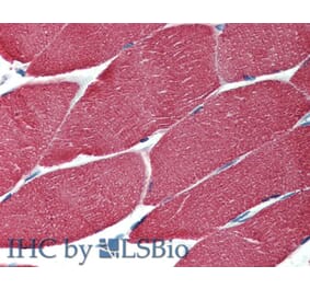 IHC - Anti-muscle Actin Antibody [HHF35] (A85719)