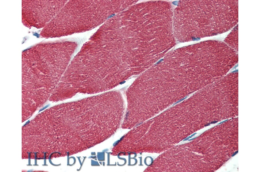 IHC - Anti-muscle Actin Antibody [HHF35] (A85719)