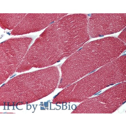 IHC - Anti-muscle Actin Antibody [HHF35] (A85719)