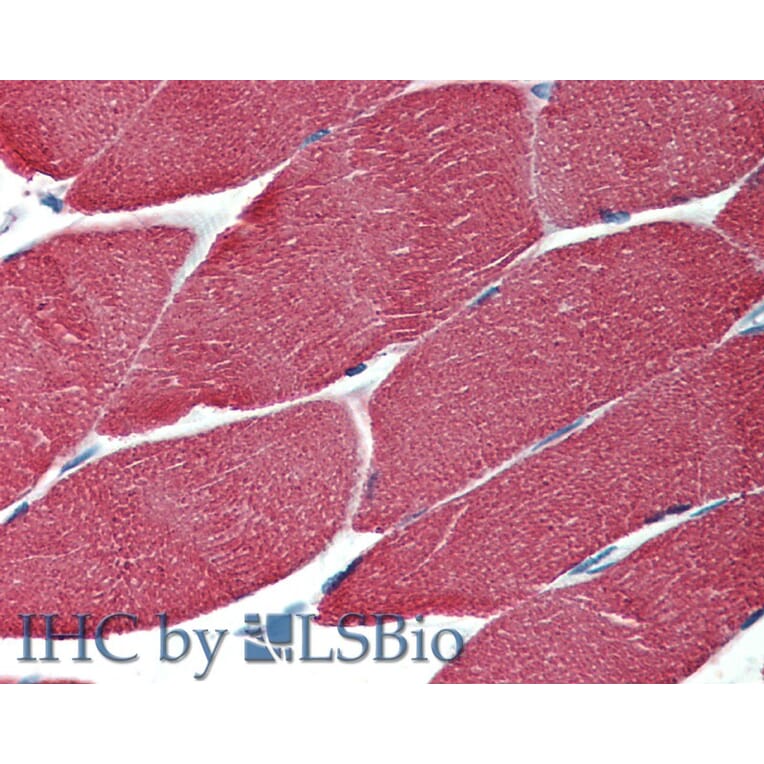 IHC - Anti-muscle Actin Antibody [HHF35] (A85719)