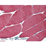 IHC - Anti-muscle Actin Antibody [HHF35] (A85719)