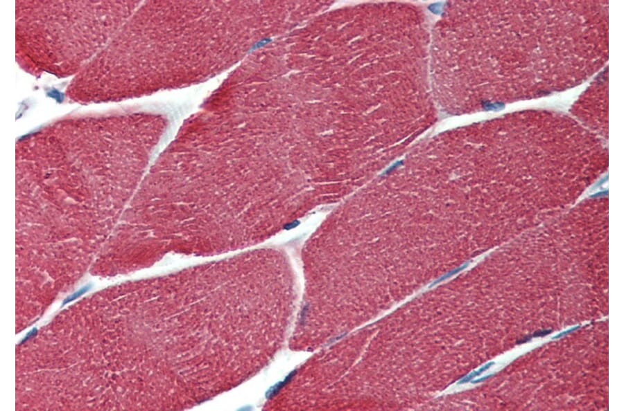 Immunohistochemistry - Anti-muscle Actin Antibody [HHF35] (A85717) - Antibodies.com