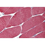 Immunohistochemistry - Anti-muscle Actin Antibody [HHF35] (A85717) - Antibodies.com