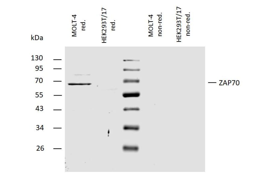 WB - Anti-ZAP70 Antibody (A85726)
