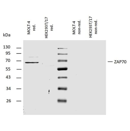 WB - Anti-ZAP70 Antibody (A85726)