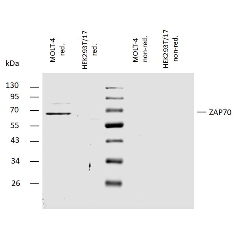 WB - Anti-ZAP70 Antibody (A85726)