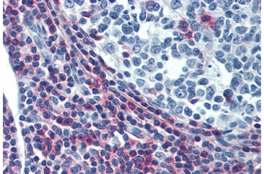 Immunohistochemistry - Anti-CD50 Antibody [MEM-04] - Low endotoxin, Azide free (A85728) - Antibodies.com