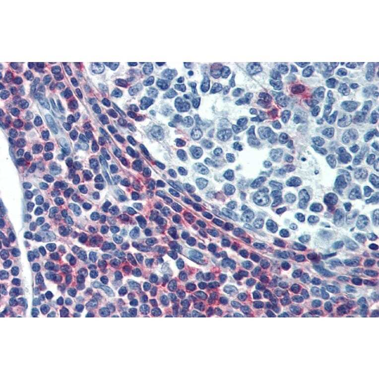 Immunohistochemistry - Anti-CD50 Antibody [MEM-04] - Low endotoxin, Azide free (A85728) - Antibodies.com