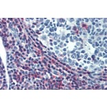 Immunohistochemistry - Anti-CD50 Antibody [MEM-04] - Low endotoxin, Azide free (A85728) - Antibodies.com