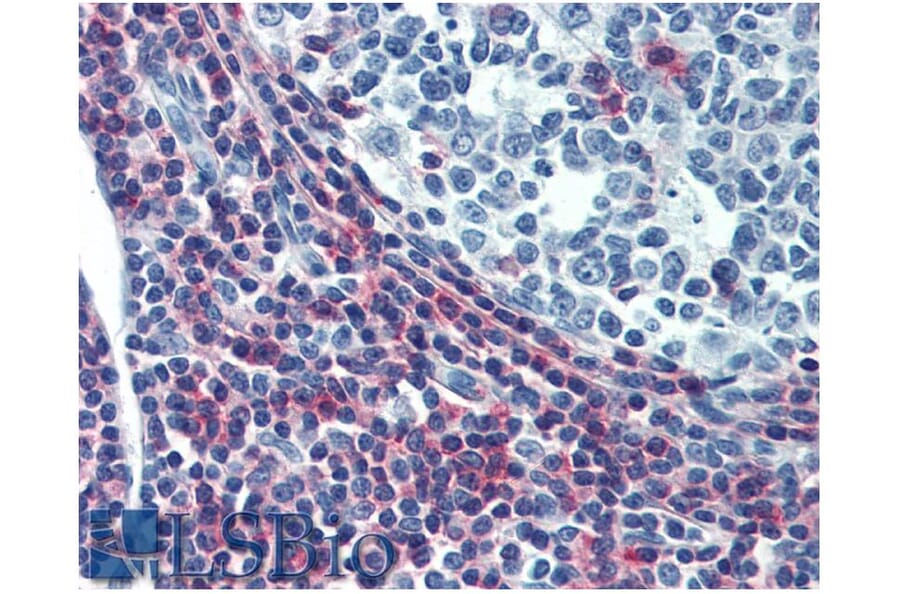 IHC - Anti-ICAM3 Antibody [MEM-04] - Low endotoxin, Azide free (A85729)