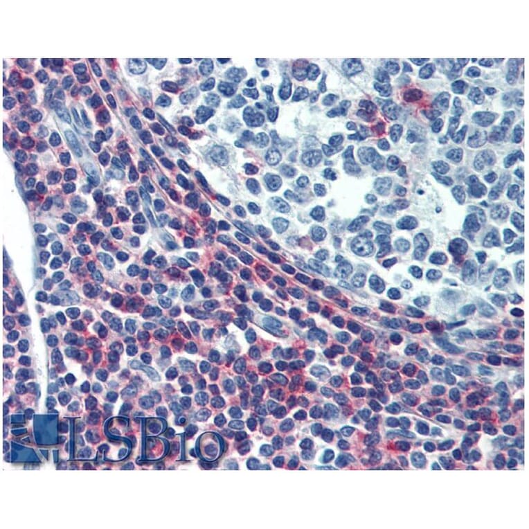 IHC - Anti-ICAM3 Antibody [MEM-04] - Low endotoxin, Azide free (A85729)