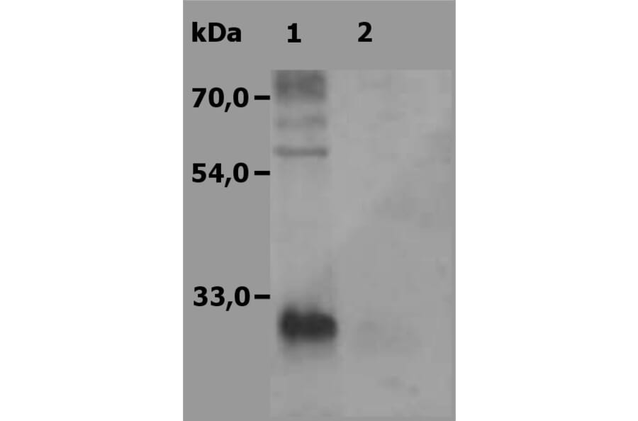 Western Blot - Anti-NTAL Antibody (A85760) - Antibodies.com