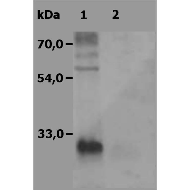 Western Blot - Anti-NTAL Antibody (A85760) - Antibodies.com