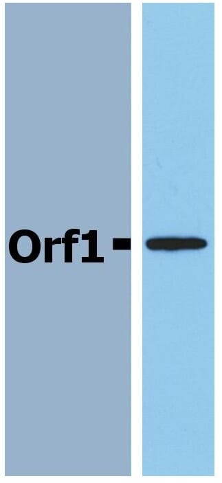 Western Blotting analysis (reducing conditions) of recombinant protein Orf1 in cell lysate of Orf1-transfected E. coli using Anti-Orf1 / FrpD Antibody (A85768).