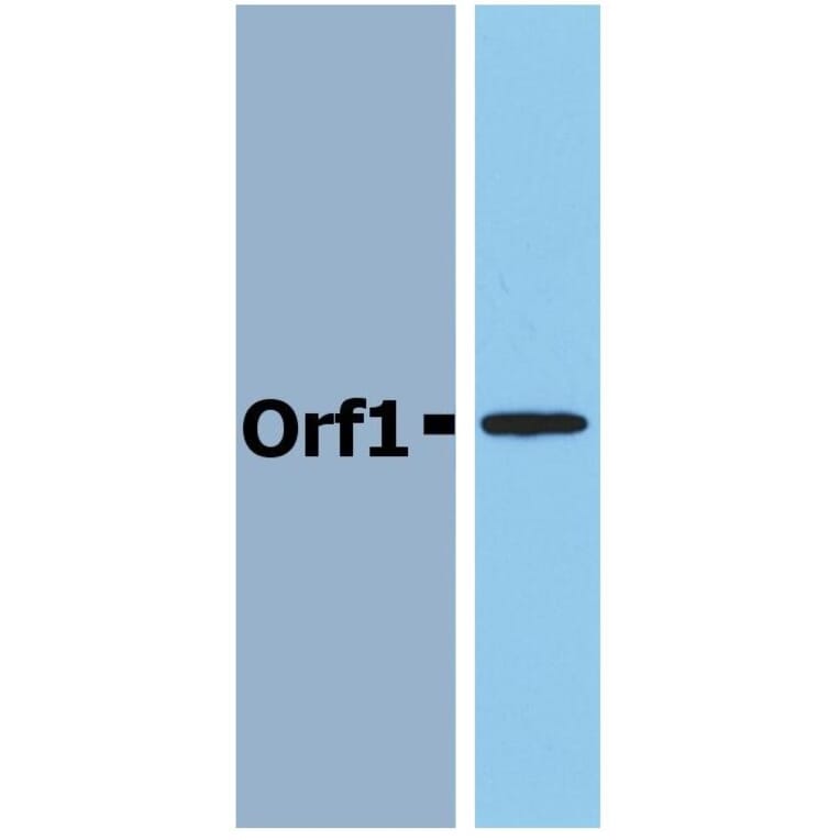 Western Blot - Anti-Neisseria meningitidis Orf1 Antibody (A85767) - Antibodies.com