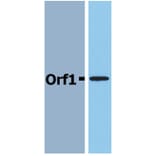 Western Blot - Anti-Neisseria meningitidis Orf1 Antibody (A85767) - Antibodies.com