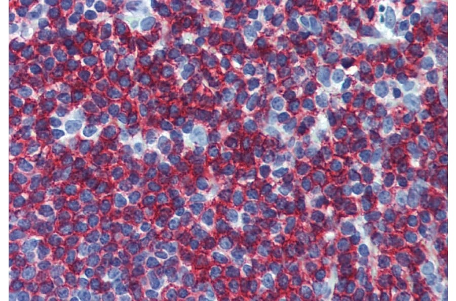 Immunohistochemistry - Anti-CD45RB Antibody [MEM-55] (A85778) - Antibodies.com