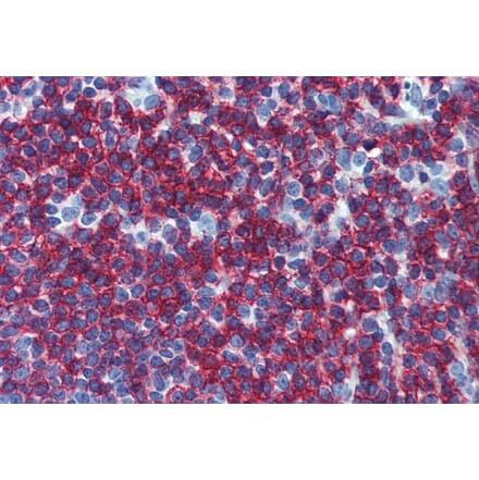 Immunohistochemistry - Anti-CD45RB Antibody [MEM-55] (A85778) - Antibodies.com