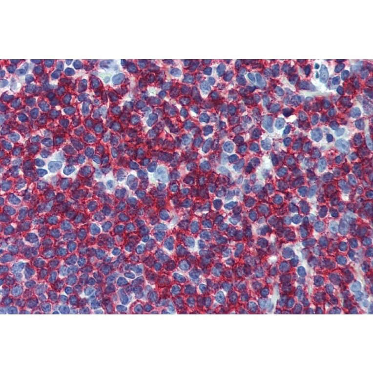 Immunohistochemistry - Anti-CD45RB Antibody [MEM-55] (A85778) - Antibodies.com