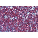 Immunohistochemistry - Anti-CD45RB Antibody [MEM-55] (A85778) - Antibodies.com