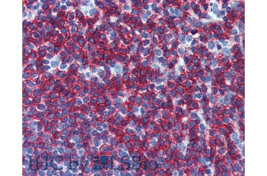 IHC - Anti-CD45RB Antibody [MEM-55] (A85780)
