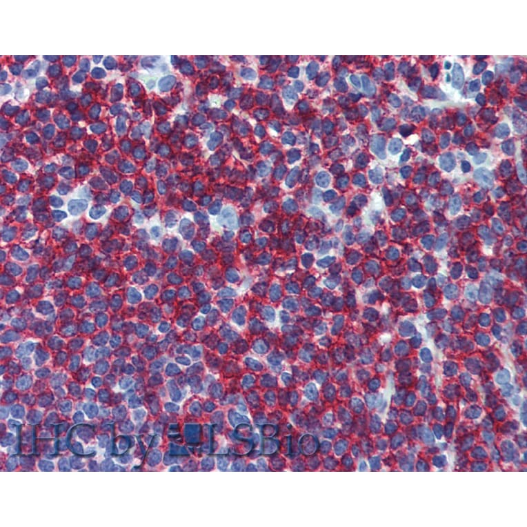 IHC - Anti-CD45RB Antibody [MEM-55] (A85780)