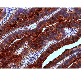 IHC - Anti-Blood Group Lewis A Antibody [7LE] (A85793)