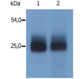 WB - Anti-NTAL Antibody (A85805)