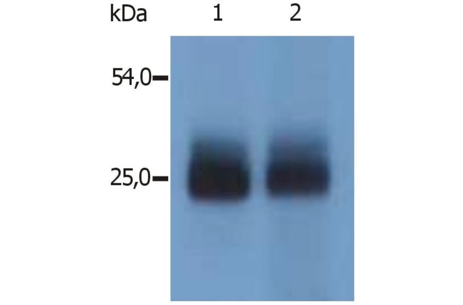 WB - Anti-NTAL Antibody (A85805)