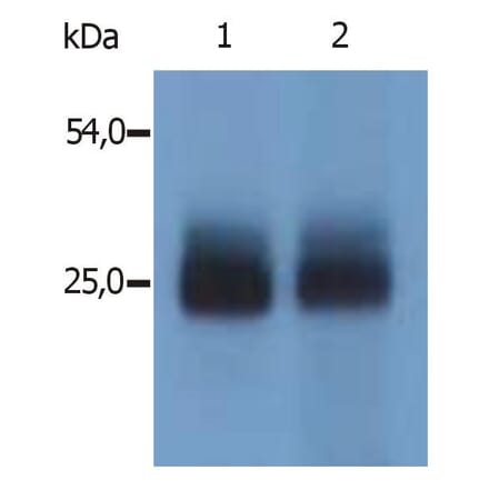 WB - Anti-NTAL Antibody (A85805)