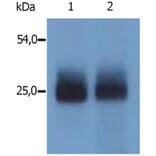 WB - Anti-NTAL Antibody (A85805)