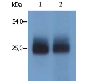 Western Blot - Anti-NTAL Antibody (A85803) - Antibodies.com
